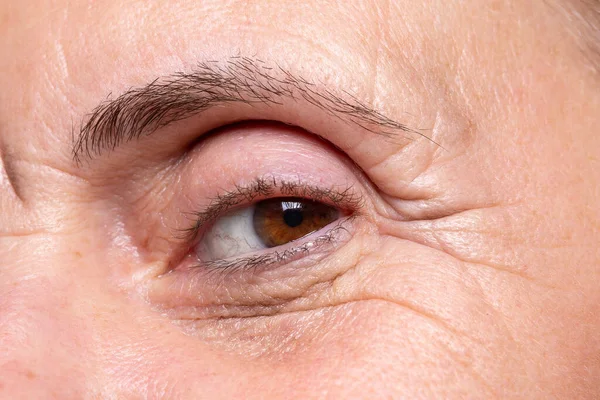 Macro image of lady eye with wrinkles