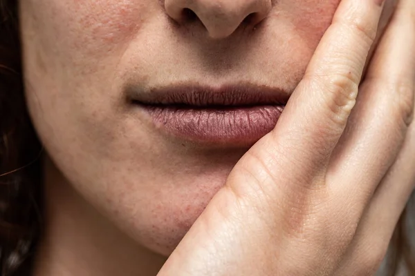 Imagen Conceptual Sobre Violencia Contra Mujer Rostro Dolorido Con Mano — Foto de Stock