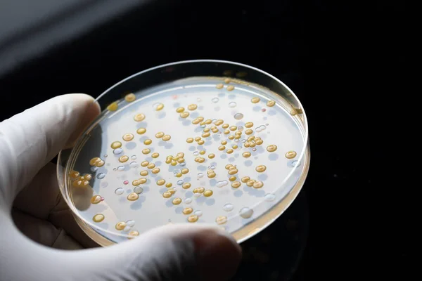Bakteri Kolonileri Kalıpları Olan Bir Petri Kabı Mavi Katı Numuneli — Stok fotoğraf