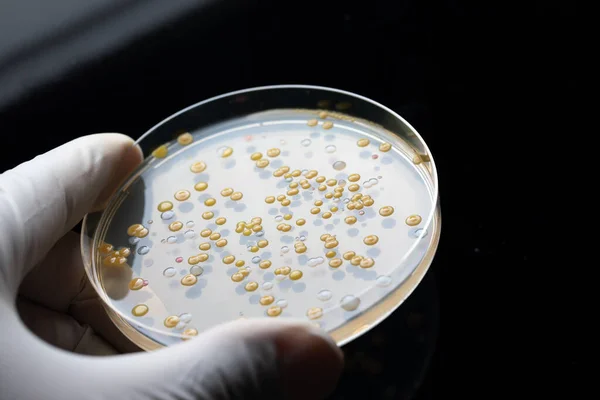 Petri dish with bacterial colonies or molds. Round lab equipment with blue solid sample held in hand wearing white sterile glove. Black background. Medical laboratory, medical glassware concept.