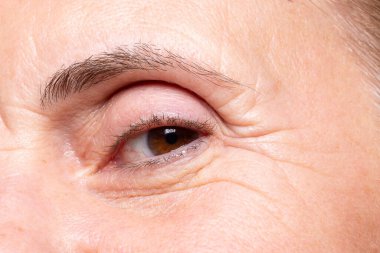 Kadın gözü üzerinde bir karga ayağı