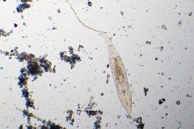 Optik mikroskop altında bir gölet damlasından rotifer.