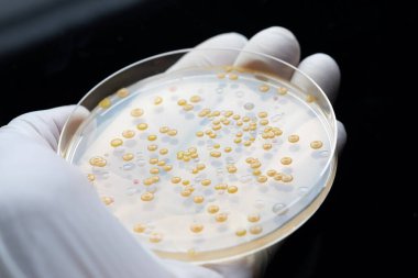 Antibiyotik direnci: ne olduğu ve neden zamanımızın en ciddi problemlerinden biri olduğu.