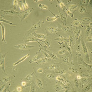 Mikroskopta insan kök hücreleri