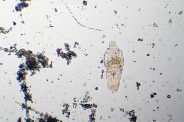 Mikroskop altında bir gölet damlasından rotifer.