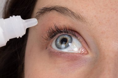 Göz yıkama çözeltisi ile tedavi edilen güzel mavi göze aşırı yakın çekim