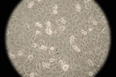 Bakteri kolonisi mikroskop altında petri kabında büyüyor.