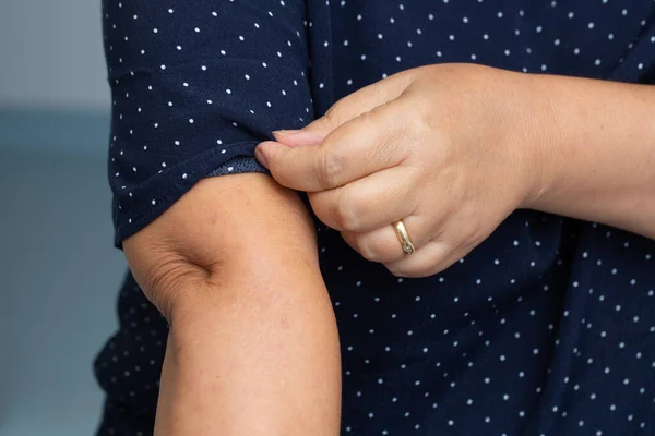 Regordeta Mujer Detalles Brazo —  Fotos de Stock