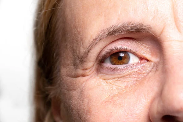 Γυναίκα Τσαλακωμένο Μάτι Πόδια Κορακιού Και Κάτω Από Σακούλες Ματιών — Φωτογραφία Αρχείου