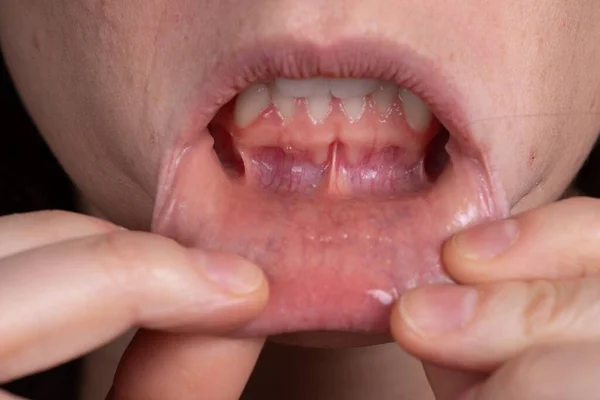 指で下唇を下に引く女性の口の詳細 — ストック写真