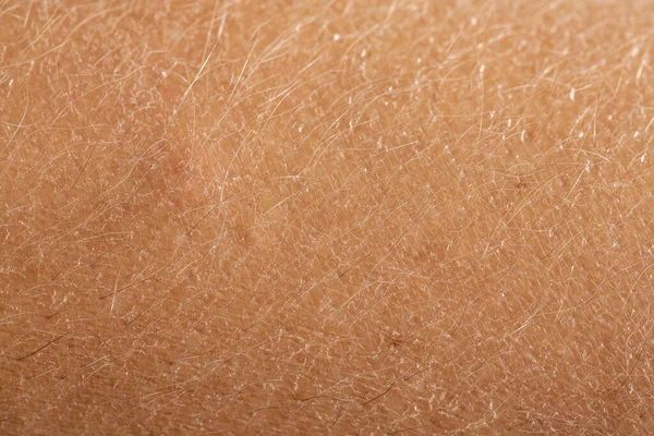 Closeup Hairs Adult Skin — Stock Photo, Image