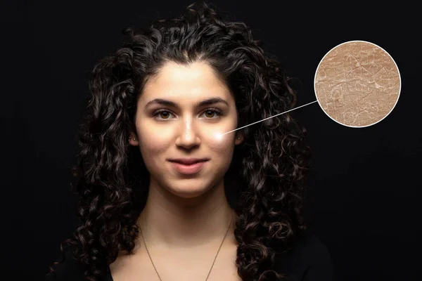 Wrinkles Dry Skin Face Caucasian Girl Concept Beauty Skin Care — Stock Photo, Image