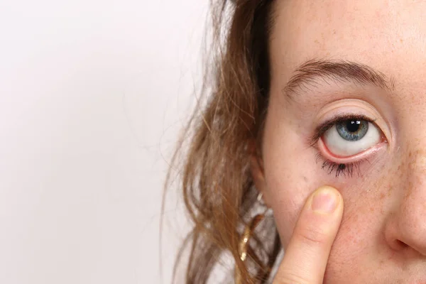 Close View Woman Face Female Stretching Skin Her Eyelid Her — Stock Photo, Image