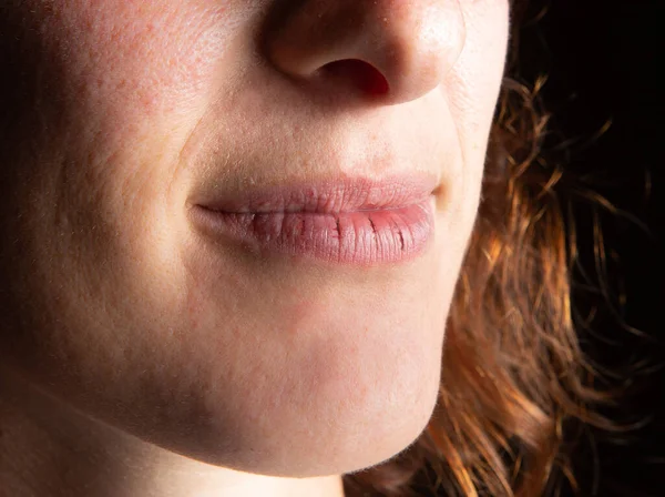 Sluiten Van Gebarsten Lippen Van Vrouw — Stockfoto