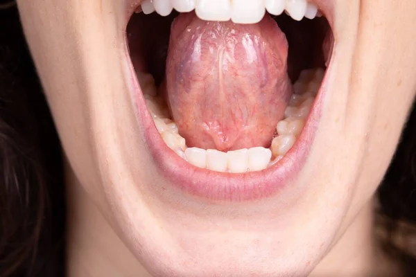 Λεπτομέρεια Του Ανοιχτού Γυναικείου Στόματος Δόντια Και Γλώσσα Ορατά — Φωτογραφία Αρχείου