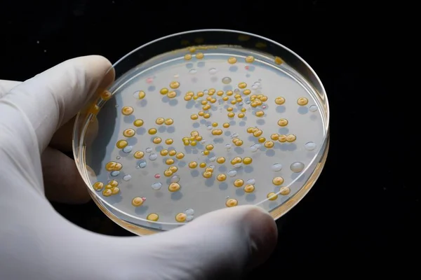 Detail Van Met Hand Bewaarde Monsteringscontainer Met Bacteriële Kolonies — Stockfoto