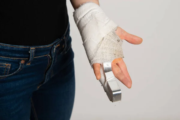 Kvinnlig Hand Vitt Handledsbandage Med Stålfixering Brutet Finger Stressfraktur Eller — Stockfoto