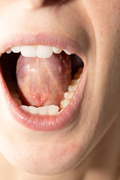 Closeup of woman\'s open mouth
