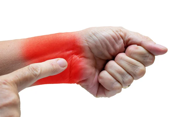 Woman Wrist Carpal Tunnel — Stock Photo, Image