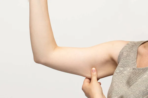 Kvinnan Nyper Den Slappa Muskeln Och Oönskad Överflödig Hud Armen — Stockfoto