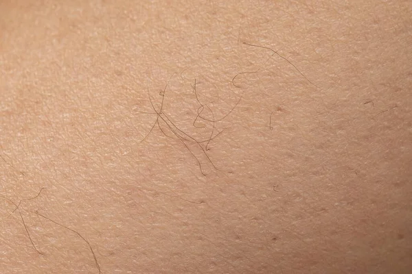 Detail of human skin with few black hairs