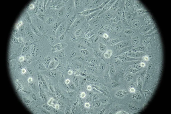 Células Cancerosas Humanas Microscopio — Foto de Stock