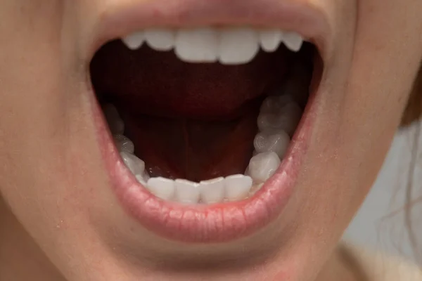 Widok Bliska Otwarte Usta Białej Pani Ujawniając Zdrowe Białe Zęby — Zdjęcie stockowe