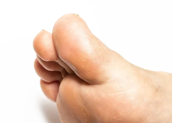 Yetişkin Ayak Parmaklarına Yakın Çekim — Stok fotoğraf