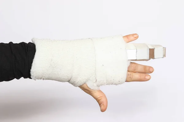 Bandagiertes Handgelenk Und Hand Mit Schiene Zur Ruhigstellung Der Gebrochenen — Stockfoto