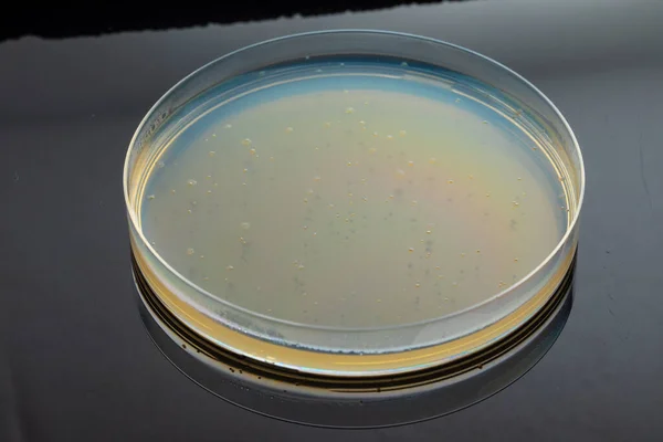 带有细菌菌落或霉菌的培养皿 圆形实验室玻璃设备 实心样品放在黑色反光桌子上 医疗实验室 医疗玻璃器皿概念 — 图库照片