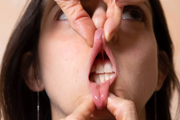 Detalhe Boca Feminina Com Lábios Puxados Verticalmente Pelas Mãos — Fotografia de Stock