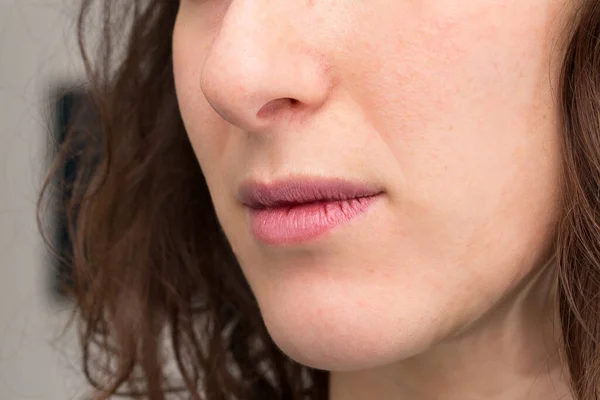 Close Lábios Rachados Mulher — Fotografia de Stock