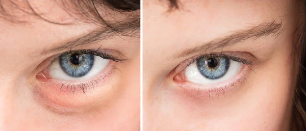 化粧品治療の結果を示す深い青色の目のクローズアップ — ストック写真