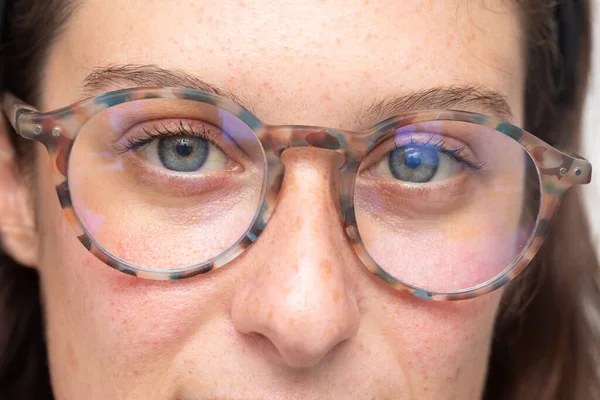 Détail Visage Jeune Femme Portant Des Lunettes Soulagement Des Yeux — Photo