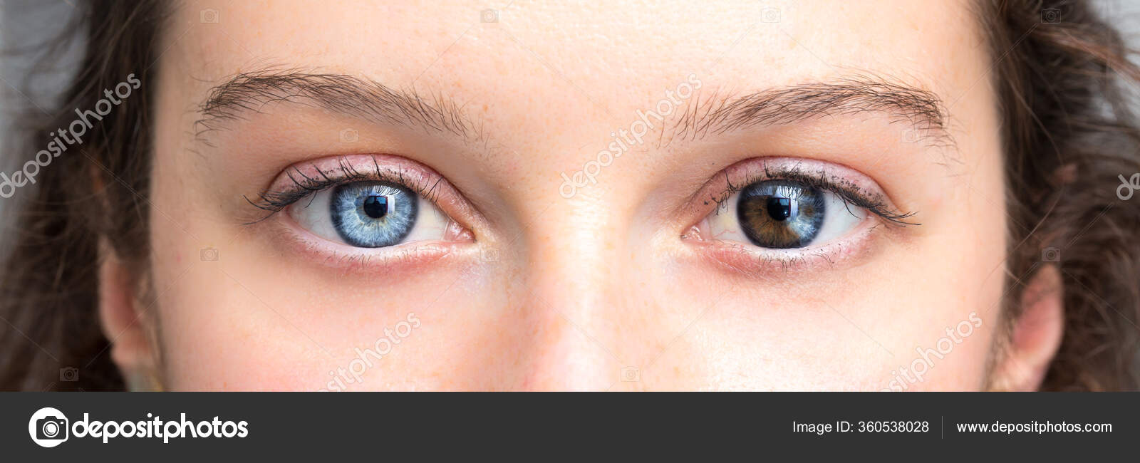 Human Heterochromia Eyes Girl Blue One Brown One Stock Photo By sruilk human-heterochromia-eyes-girl-blue-one-brown-one-stock-photo-by-sruilk