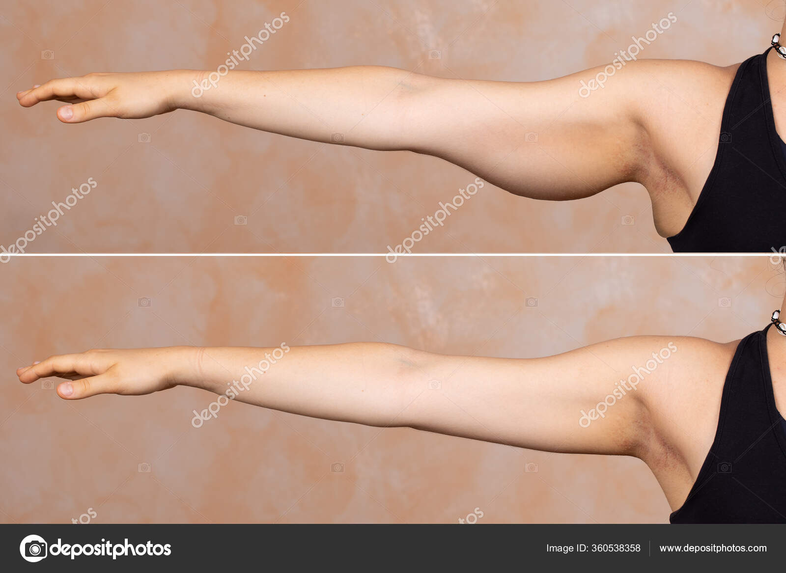 Упражнения для подтяжки овала лица. Упражнения от второго подбородка. Подтянуть мышцы рук. Подтяжка мышц. Упражнения для лица и шеи.