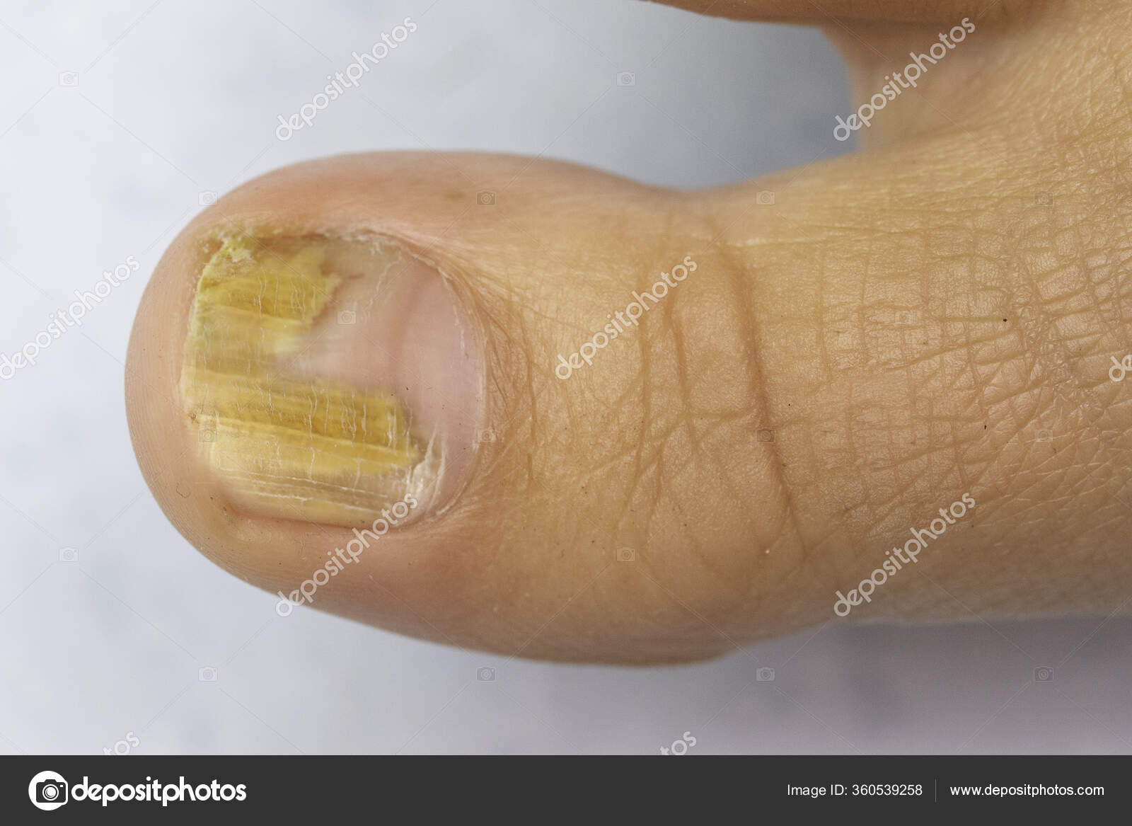 ポートフォリオ Sruilk ページ 4 ストック写真 イラストとベクターアート Depositphotos