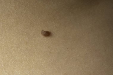 Derideki benin yakın görüntüsü