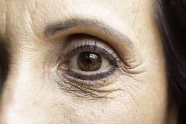 Çok sayıda karga ayağı kırışıklığı olan yaşlı bir kadın derisi. 