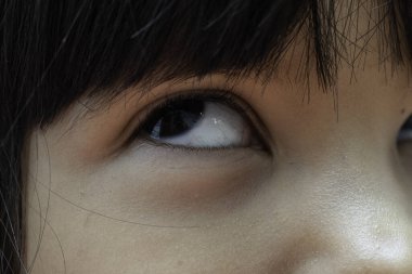 Epilepsi nöbeti geçiren küçük bir çocuğun yüzüne aşırı yakından bakmak, ebeveynlere acil tıbbi yardım istemeleri için bir uyarı işareti olarak gözler geri yuvarlanmaya başlar..