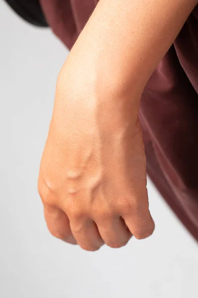 Widok Bliska Powieszoną Rękę Młodej Białej Kobiety Powiększonymi Żyłami Palmowymi — Zdjęcie stockowe