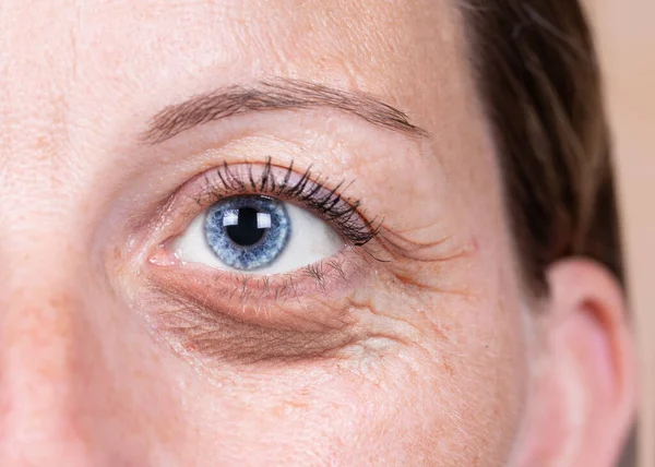 Uma Vista Perto Olho Azul Uma Senhora Caucasiana Quarenta Poucos — Fotografia de Stock