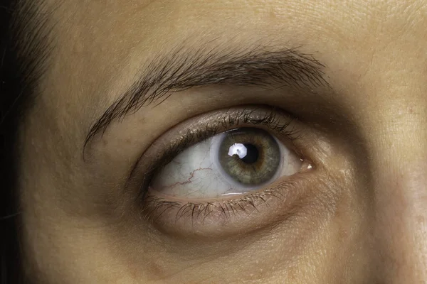 Mulher Olhando Para Lados Mostrando Capilares Olhos Perto — Fotografia de Stock