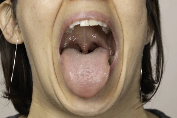 Tongue, throat examination close up