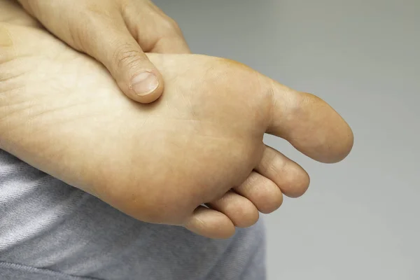 Mensch Barfuß Gesunde Gepflegte Sohle Aus Nächster Nähe — Stockfoto