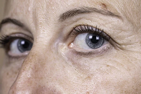 Closeup Side View Blue Eyes Mature Lady Showing Crow Feet — Stock Photo, Image