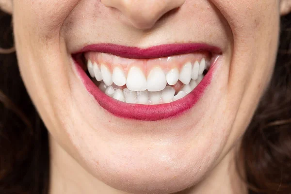 Ortodonzia Odontoiatria Prevenzione Cura Della Carie Sorriso Perfetto — Foto Stock