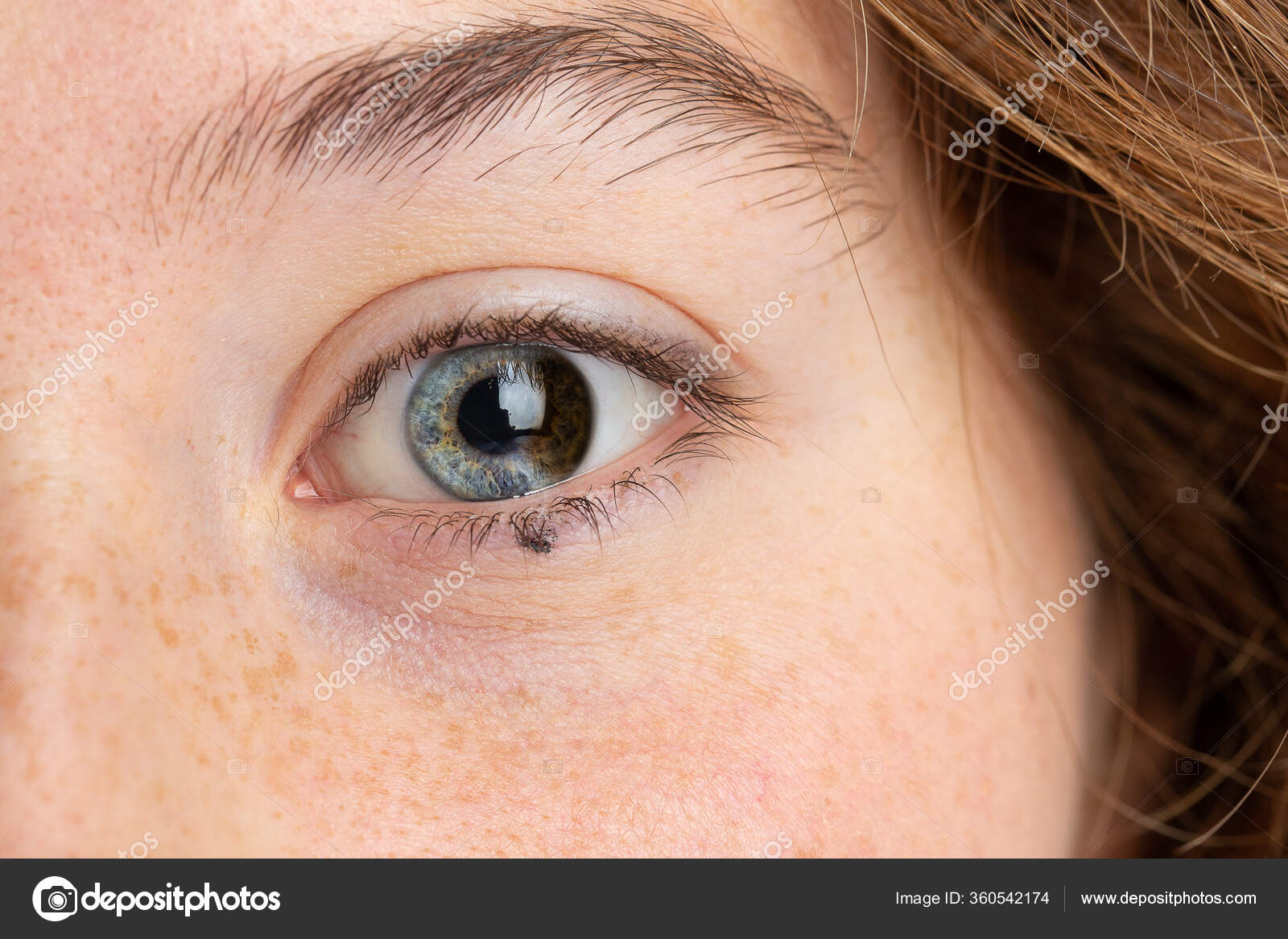 Beautiful Heterochromia Ph 