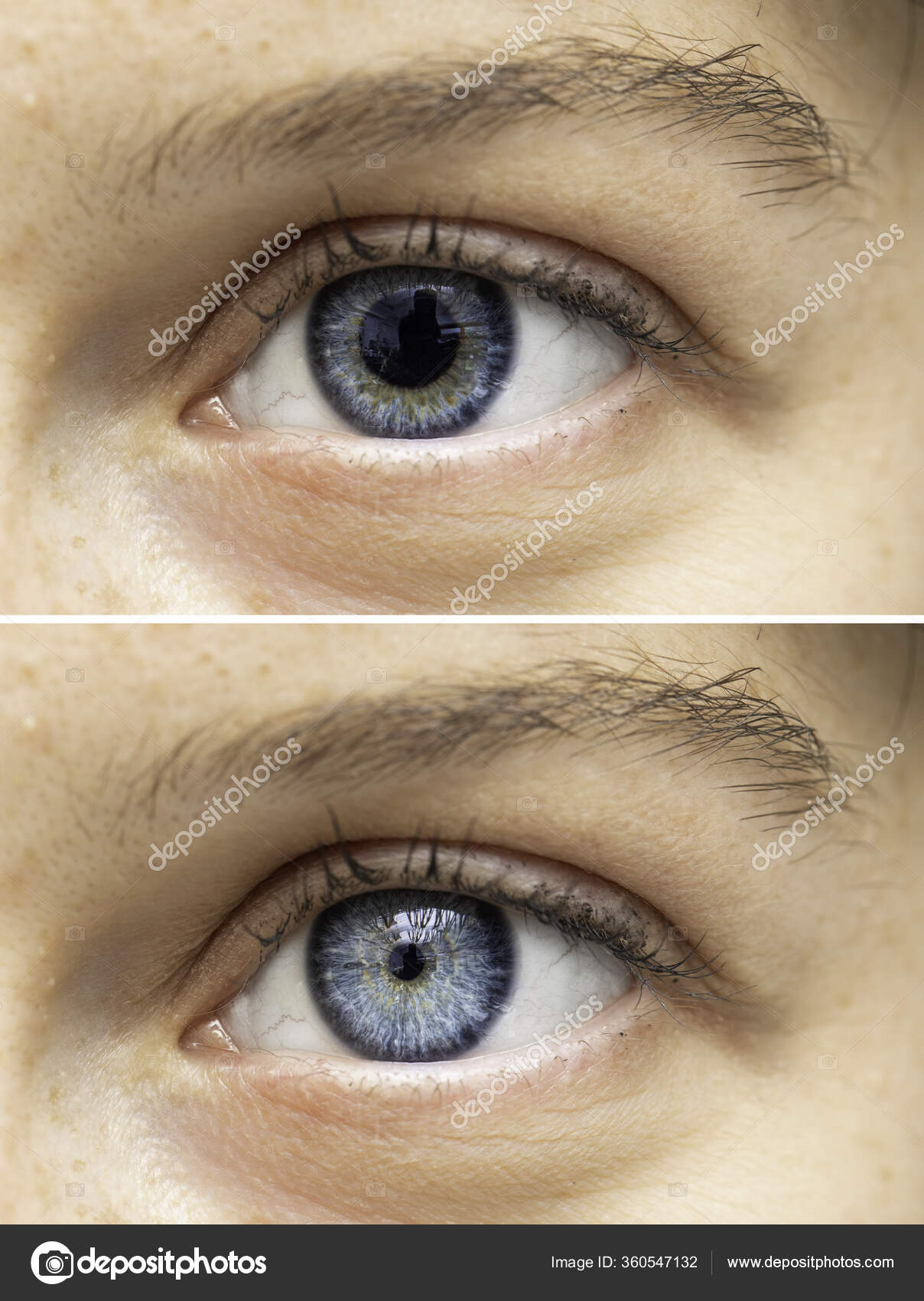 인간의 동공의 — 스톡 사진 © sruilk #360547132, image size:1208x1700