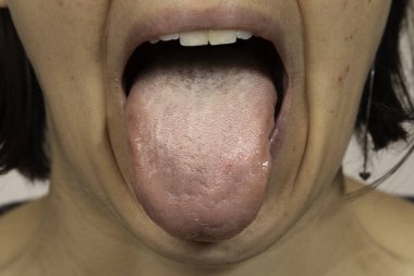 İnsan dili, ağzını kapat.